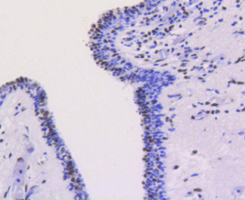 Ku80 Recombinant Rabbit Monocl