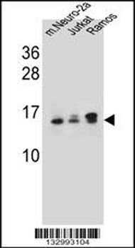 UBE2E2 Antibody (N-term)抗体,orb
