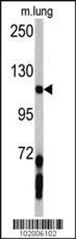 PDGFRA Antibody (C-term E1063)