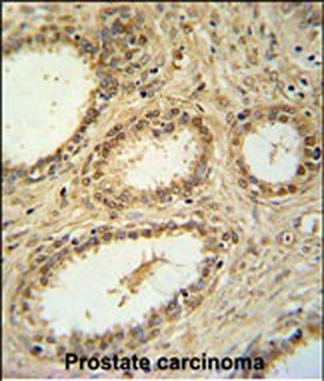 SNRNP40 Antibody (Center)抗体，or