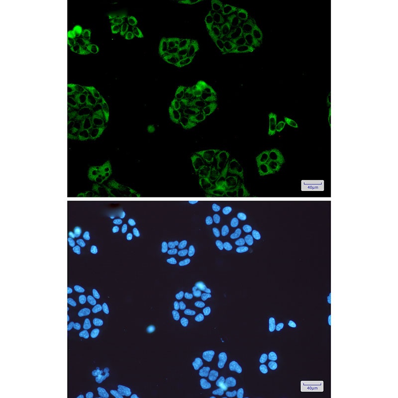 Vinculin Rabbit mAb抗体,orb15640