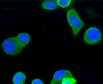 Beta Tubulin Recombinant Rabbi