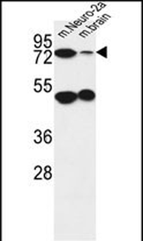 AVL9 Antibody (C-term)抗体,orb35