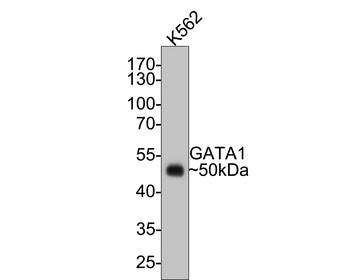 GATA1 Recombinant Rabbit Monoc