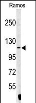 XPOT Antibody (N-term)抗体，orb38