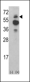 ACK1 Antibody (N-term)抗体，orb38