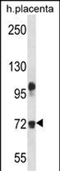 FBLN1 Antibody (C-term)抗体，orb3