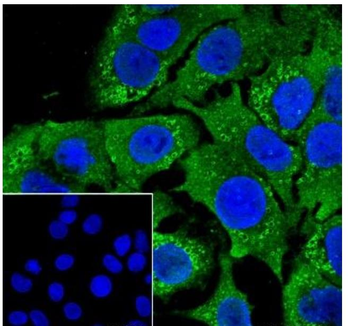 PLIN2 Recombinant Rabbit Monoc