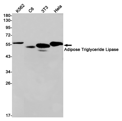 Adipose Triglyceride Lipase Ra