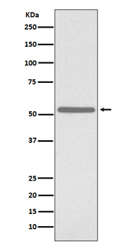 Cdc25C Rabbit mAb [KD Validate