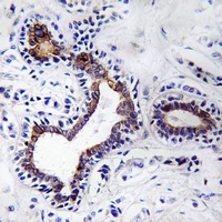 Fibulin 3 Antibody抗体，orb147469