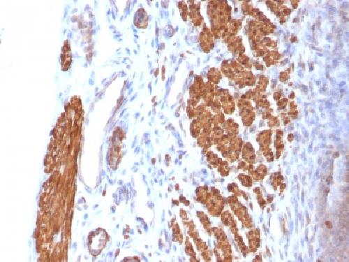 Calponin-1 (Smooth Muscle Mark
