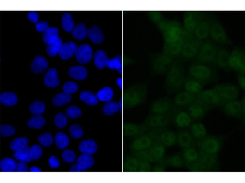 BRD2 Recombinant Rabbit Monocl
