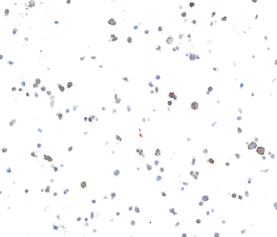 Rabbit anti-LAG3 Recombinant M