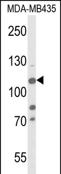 JMJD2B Antibody (T305)抗体,orb14