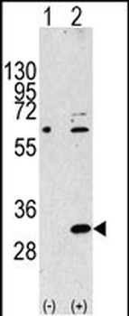 EIF4E2 Antibody (N-term)抗体，orb
