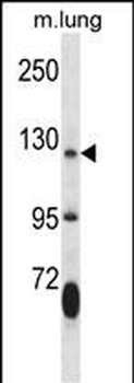 JAK2 Antibody (Center)抗体，orb32