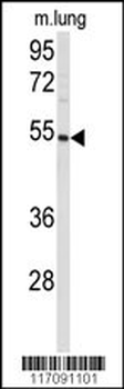 CYP8A1 Antibody (N-term)抗体，orb