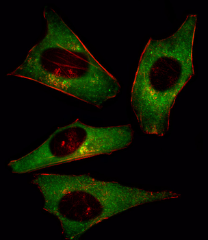 PI3KCD Antibody (N-term)抗体，orb