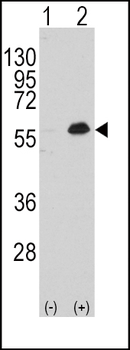 MEF2C Antibody (T300)抗体，orb364
