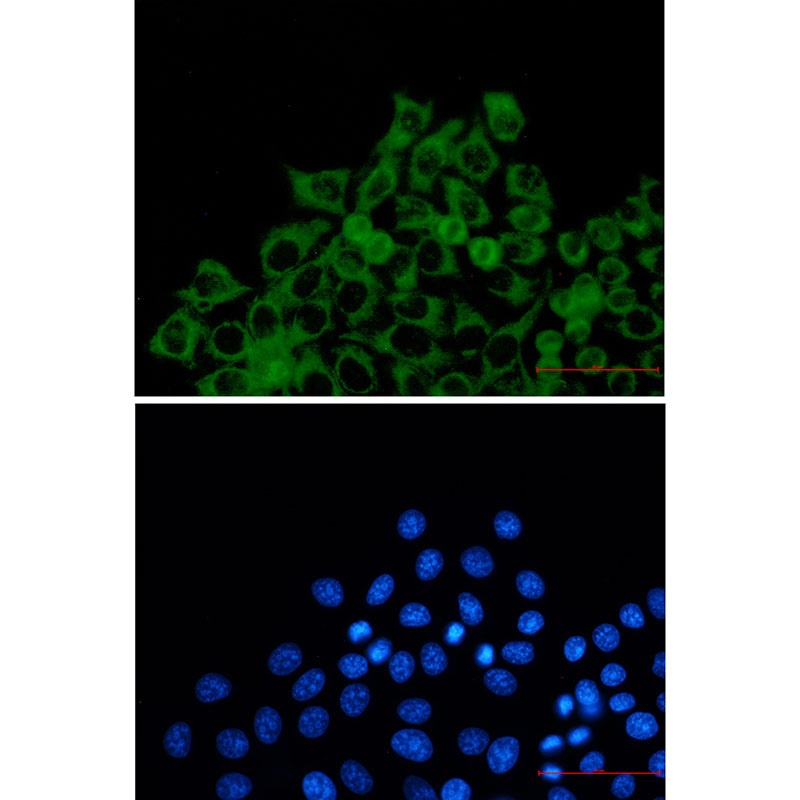 TOMM20 Rabbit mAb抗体，orb1563033
