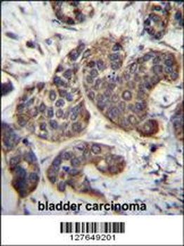 GOT1B Antibody (C-term)抗体，orb3