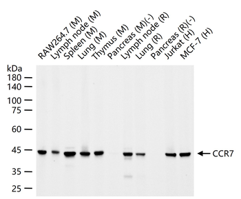 CCR7 Recombinant Rabbit Monocl