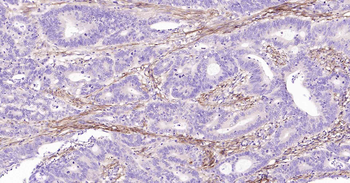 Podoplanin Recombinant Rabbit 