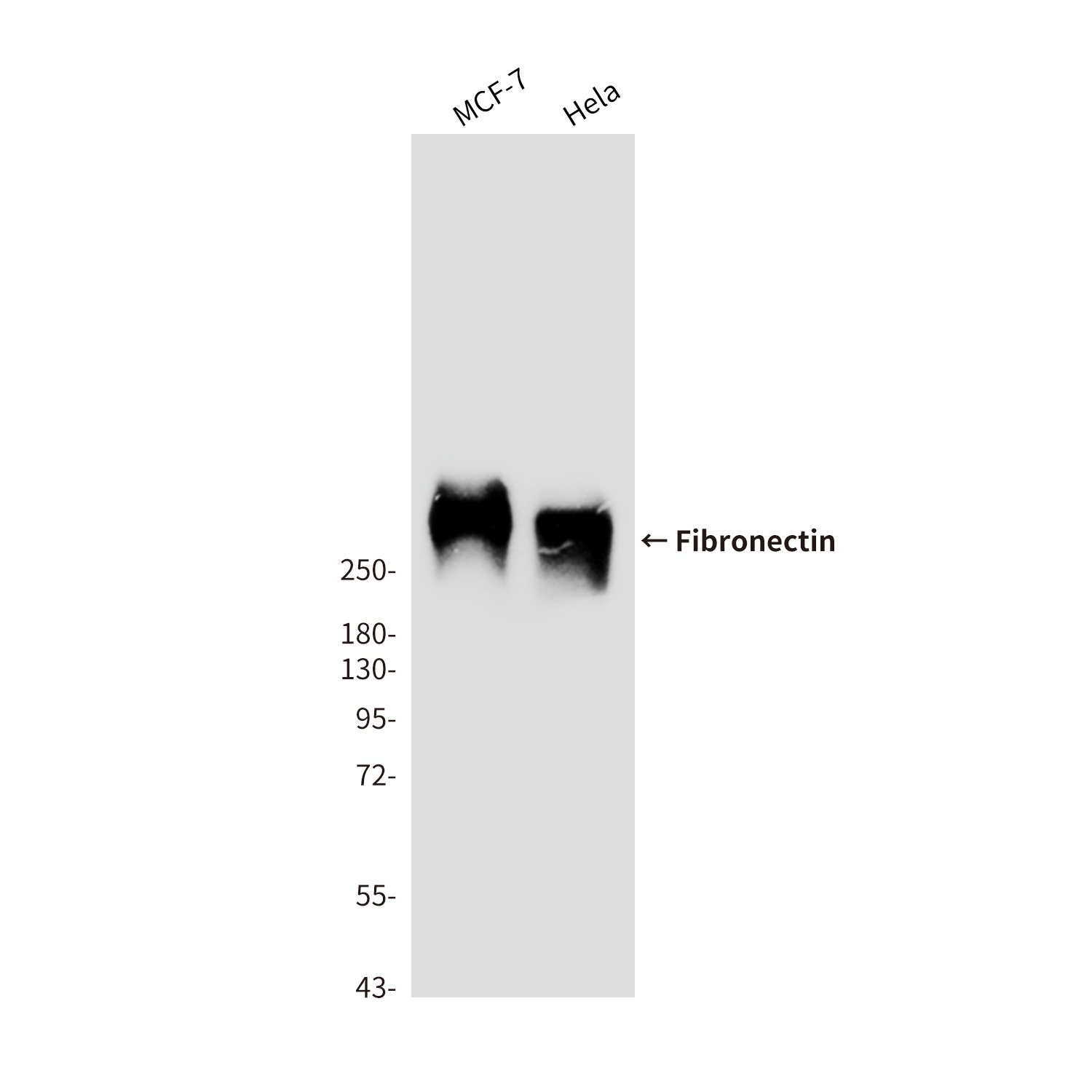 Fibronectin (1E2) Mouse mAb抗体,