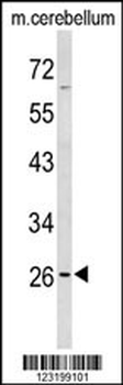 PXMP4 Antibody (Center)抗体，orb1