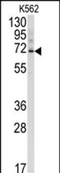 Ubiquilin3 Antibody (N-term)抗体
