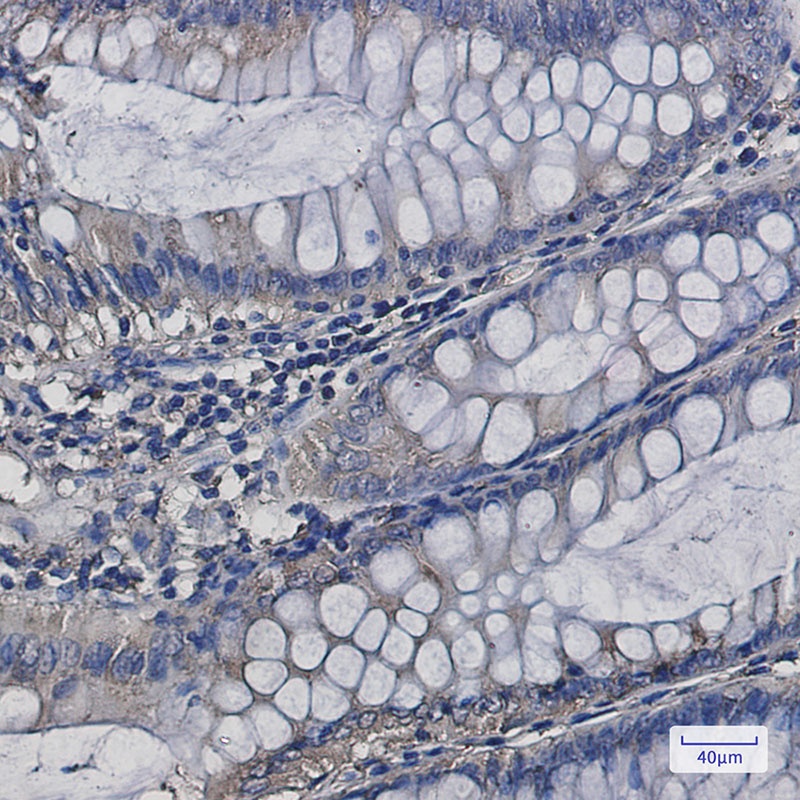 SERCA2 ATPase Rabbit mAb抗体,orb