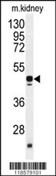 POLDIP2 Antibody (C-term)抗体,or