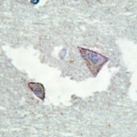 PDGFR alpha (Phospho-Y754) Ant