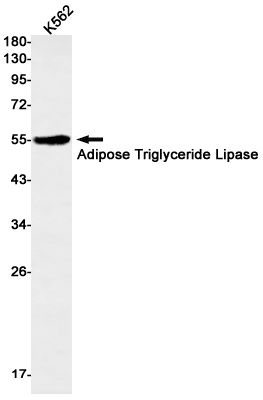 Adipose Triglyceride Lipase Ra