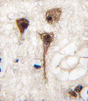 MEF2C Antibody (T300)抗体，orb364