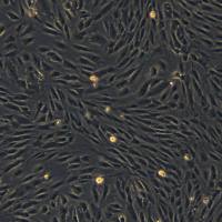 浙江美森-人肺微血管内皮细胞 