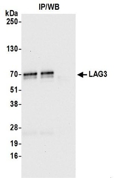 Rabbit anti-LAG3 Recombinant M