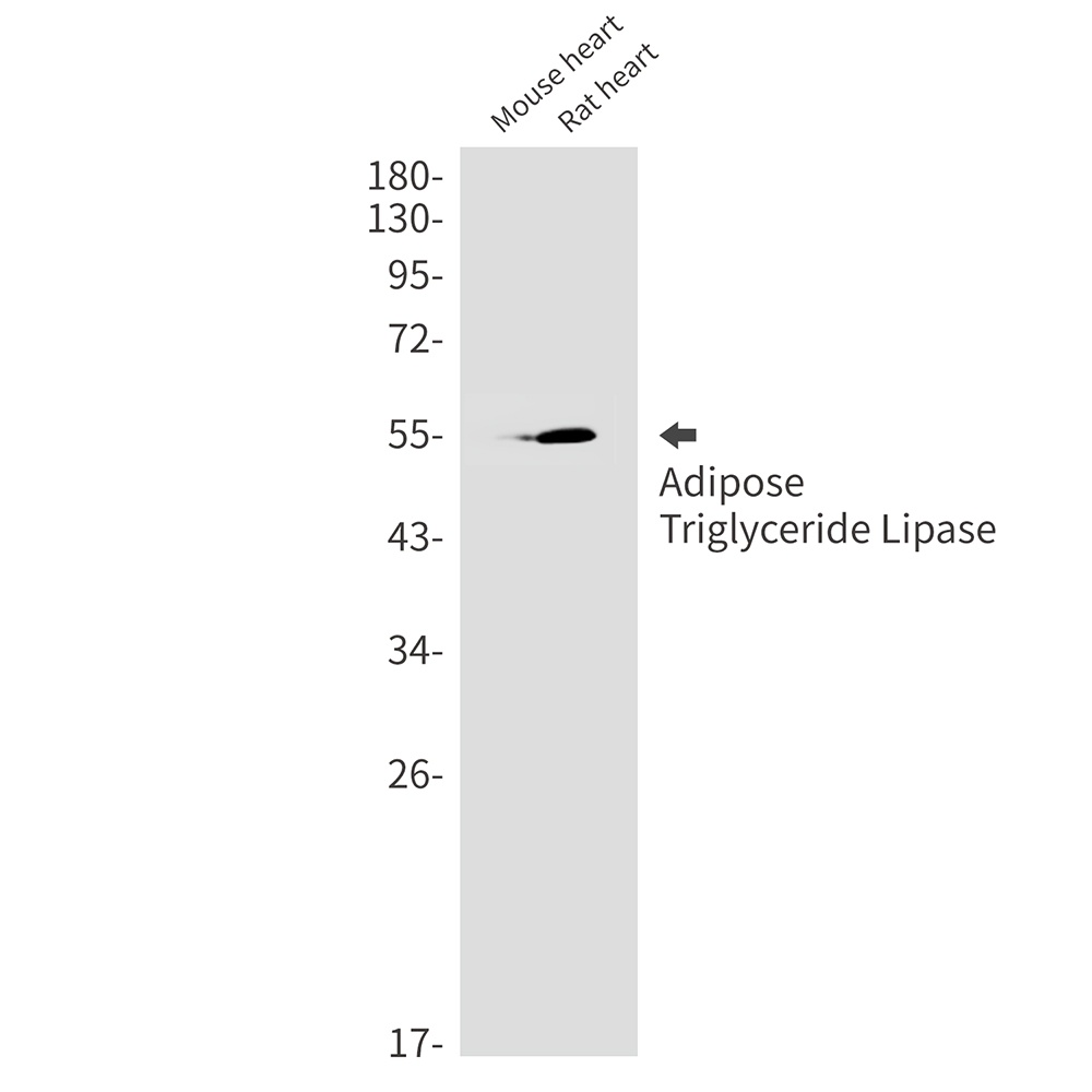 Adipose Triglyceride Lipase Ra