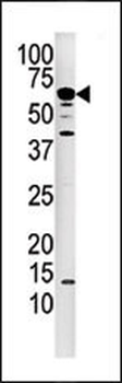 Calcineurin (PPP3CA) Antibody 
