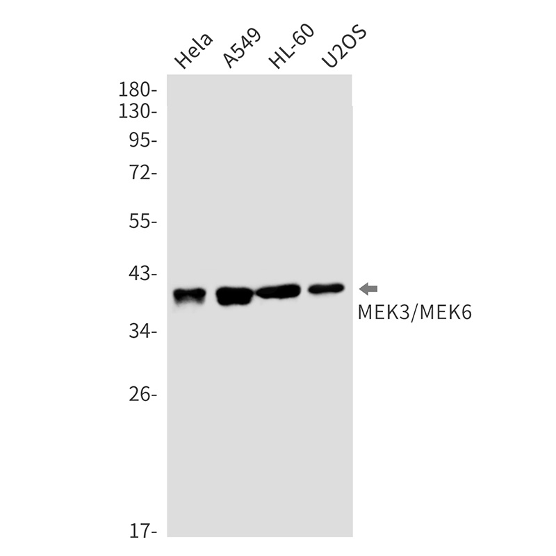 MEK3/MEK6 Rabbit mAb抗体，orb1563