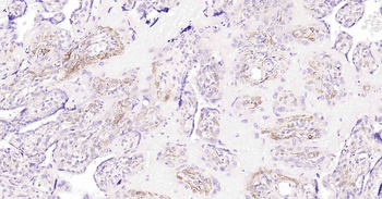 Podoplanin Recombinant Rabbit 