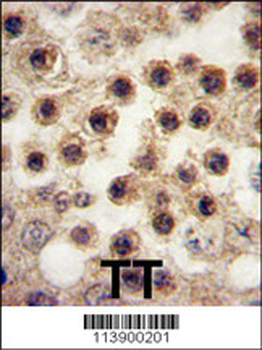 YBX2 Antibody (C-term)抗体，orb14