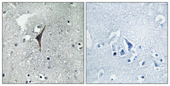 eNOS Rabbit pAb抗体，orb1562986，b