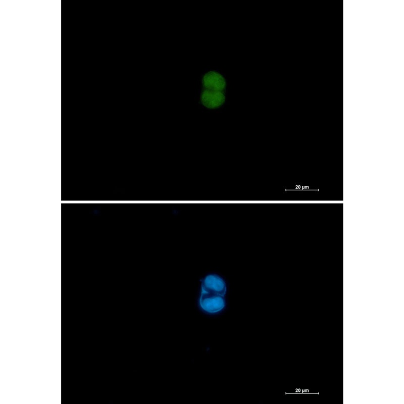 MEK3/MEK6 Rabbit mAb抗体，orb1563