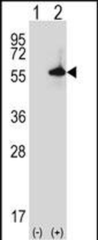 Mouse Sgk3 Antibody (C-term)抗体