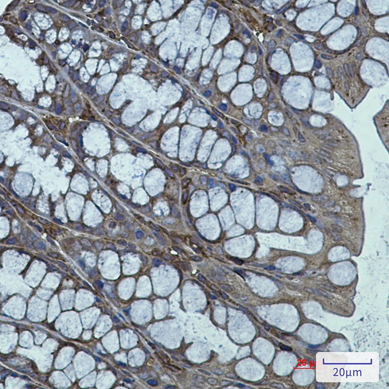 Actin Related Protein 3 Rabbit