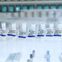 冰冻人血清中总胆红素、直接胆红素系列标准物质