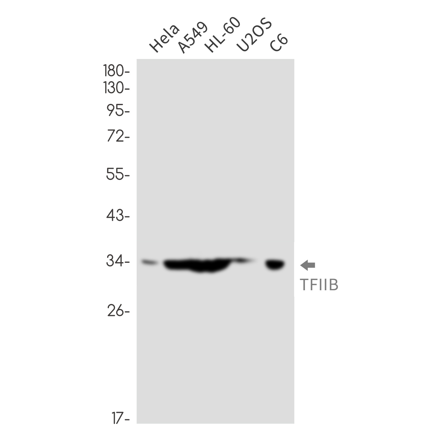 Transcription Initiation Facto