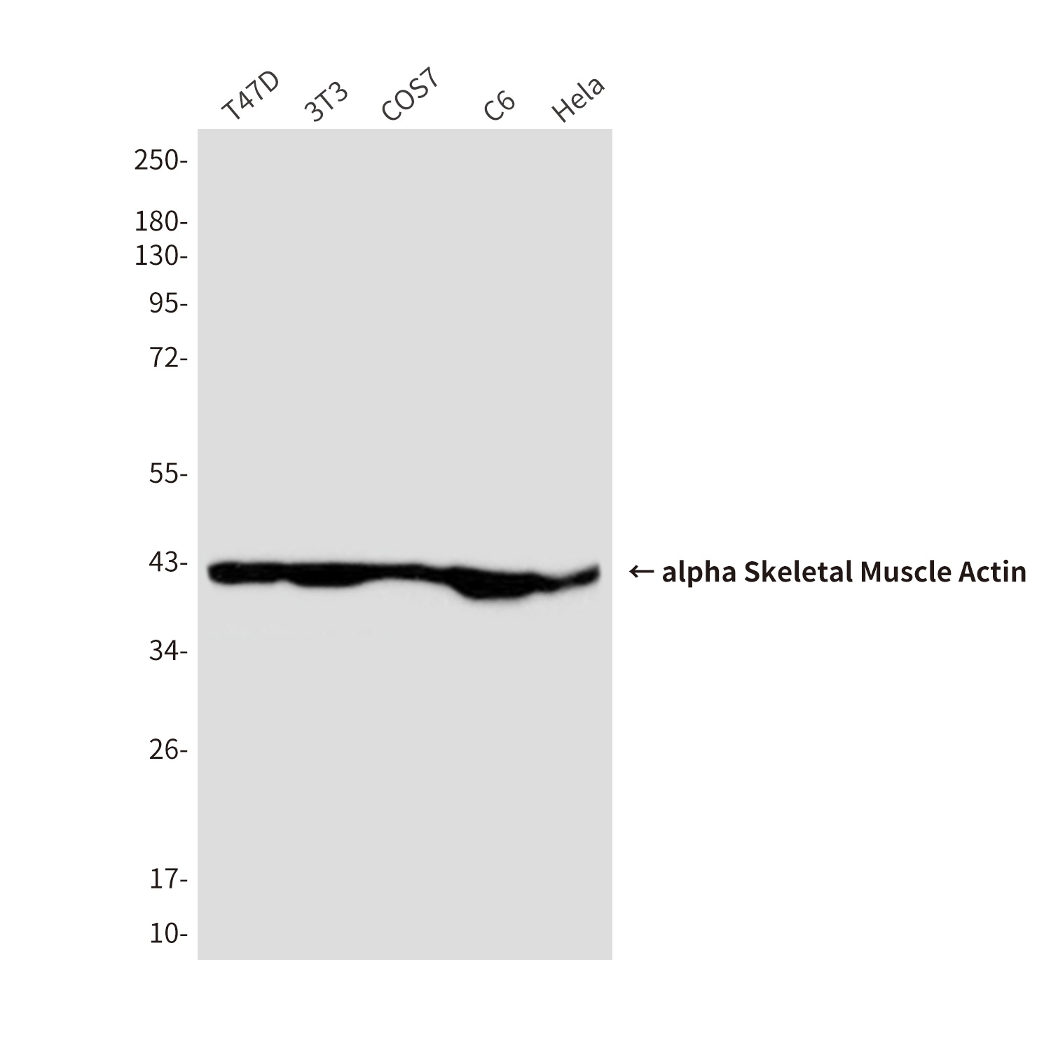 alpha Skeletal Muscle Actin (2